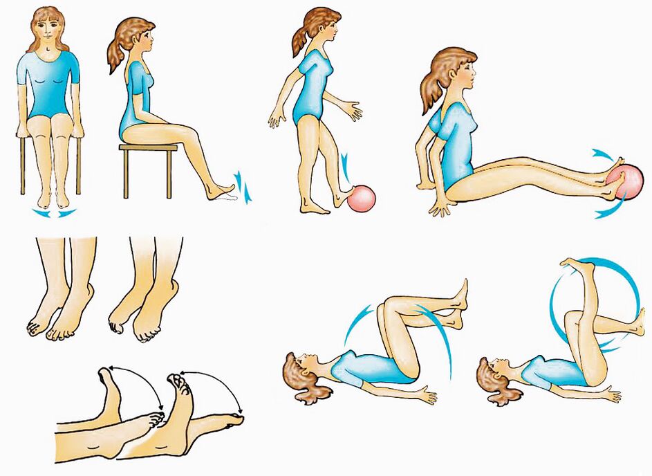 Exercise for varicose veins